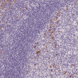 FAM46C Antibody, Novus Biologicals 25ul | Buy Online | Novus Biologicals | Fisher Scientific